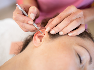 Ilustração dos pontos de acupuntura na orelha usados na auriculoterapia