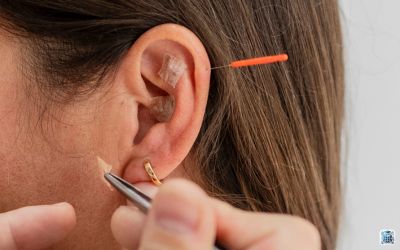 Auriculoterapia vibratória com cristais de quartzo